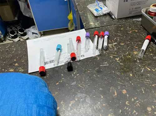 重医一院做试管成功率高吗！重庆医科大学附属第一医院试管成功率！,3代试管包男女
